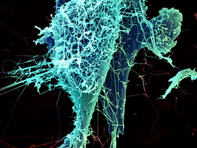 String-like Ebola virus particles are shedding from an infected cell in this electron micrograph. Credit: NIAID