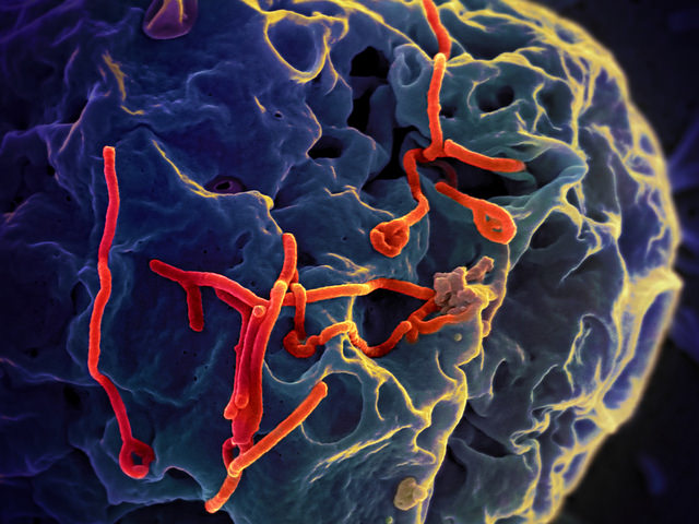 Scanning electron micrograph of Ebola virus budding from the surface of a Vero cell (African green monkey kidney epithelial cell line. Credit: NIAID
