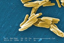 Under a high magnification of 15549x, this colorized scanning electron micrograph (SEM) depicted some of the ultrastructural details seen in the cell wall configuration of a number of Gram-positive Mycobacterium tuberculosis bacteria.